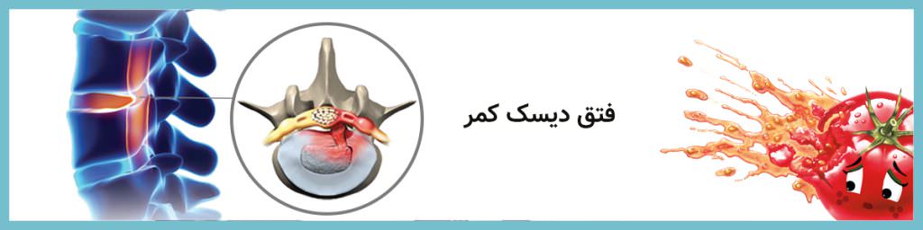 پشتی طبی باراد