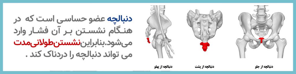 به نشین ارگونومیک ارتوپدی باراد - درد دنبالچه