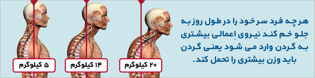 گردن درد