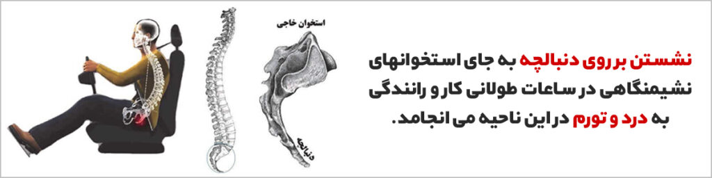 نشستن بر روی دنبالچه