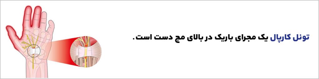 تونل کارپال