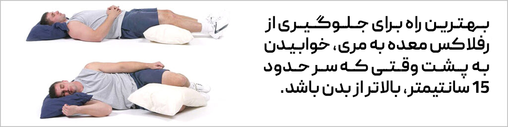نشان دادن خوابیدن صحیح برای جلوگیری از رفلاکس معده