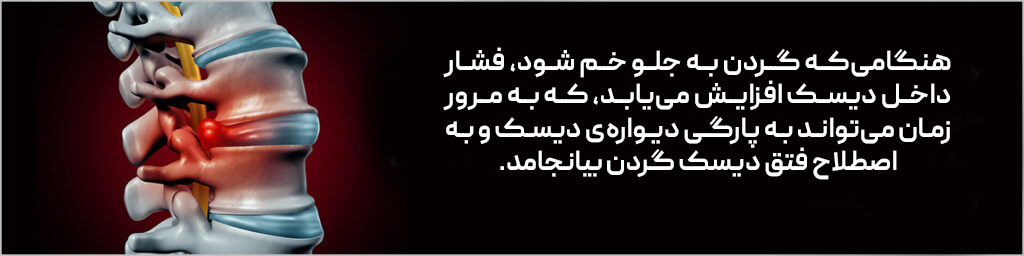 افزایش فشار به گردن در اثر خم شدن گردن به جلو