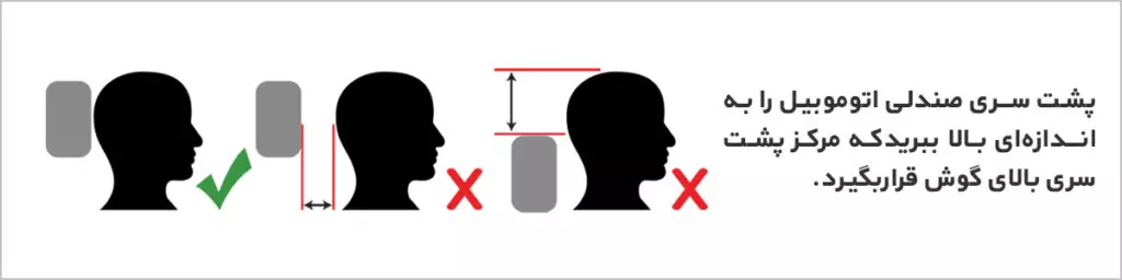 روش تنظیم پشت سری اتوموبیل .